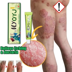 YIGANERJING 15g Herbal Cream | Treats Psoriasis, Eczema, and Psoriasis | Natural Herb Formula | Antibacterial, Soothes Itching, Repairs Skin, Ideal Cream for Skin Conditions