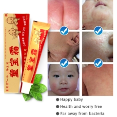 YIGANERJING Infant Soothing Cream - 15g, for baby's delicate skin. Relieves allergies, treats eczema, and dryness. Herbal formula ensures gentle care.