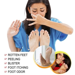 YIGANERJING Chinese herbal antibacterial spray can relieve foot troubles, relieve itching, deodorize and sweat, and protect healthy feet