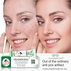 30g Yiganerjing Anti Acne Cream Chinese Herbal Pimples Blackhead Removal Cream Acne Treatment Gel