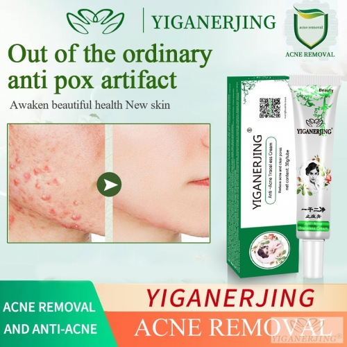 30g Yiganerjing Anti Acne Cream Chinese Herbal Pimples Blackhead Removal Cream Acne Treatment Gel