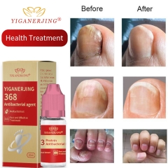 YIGANERJING 368 Antibacterial Treatment Essence: Restore toenail health, resist fungus, regain confident feet
