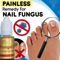 YIGANEJRING Antifungal Solution for Nail Fungus 20ML: Powerful Antimicrobial, Prevents Recurrence, Improves Nail Health, Long-lasting Care, Effective Solution for Nail Fungus.