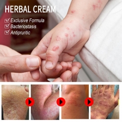 QINGFANGLI Clean and Clear Herbal Cream, effectively treats skin conditions like psoriasis, eczema, and dermatitis. Relieves itching, with notable antibacterial properties. Contains 15g, packaging is box-free.